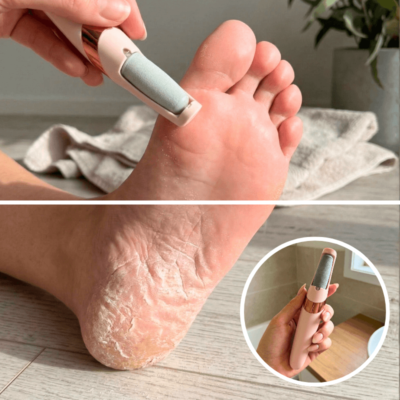 SmoothFeet™ Pro