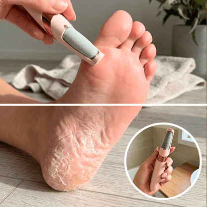 SmoothFeet™ Pro